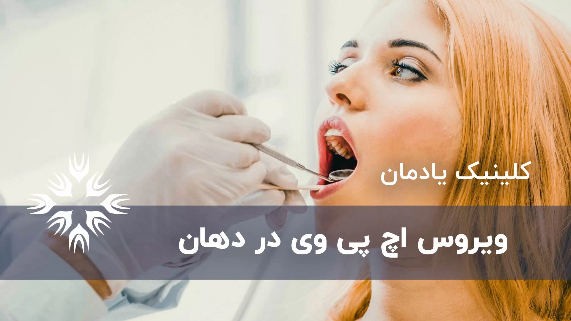 زگیل دهانی چیست و چگونه تشخیص داده می‌شود؟