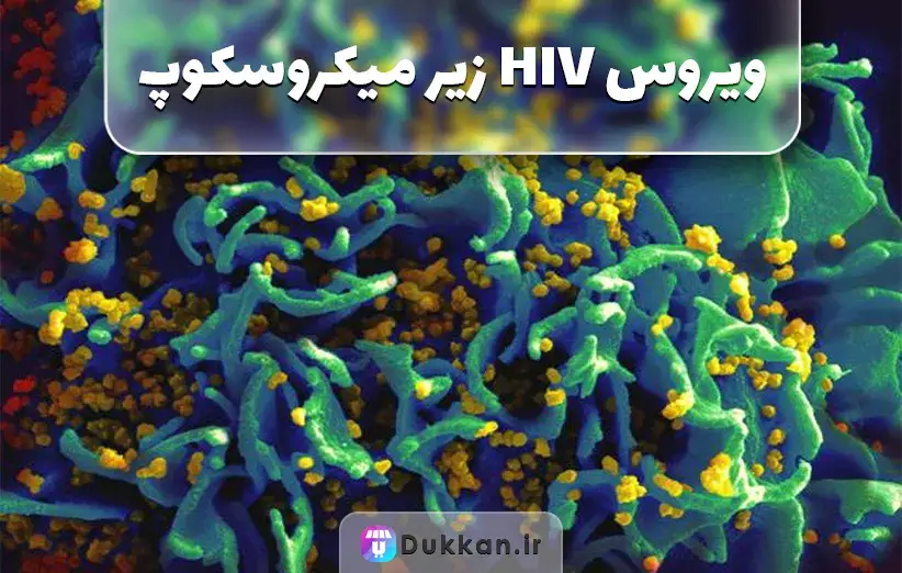 علائم بیماری ایدز در چشم چیست؟ - کیت ایدز و کیت هپاتیت - تشخیص ایدز از روی چشم علائم بیماری ایدز در چشم چیست؟ - کیت ایدز و کیت هپاتیت - تشخیص ایدز از روی چشم