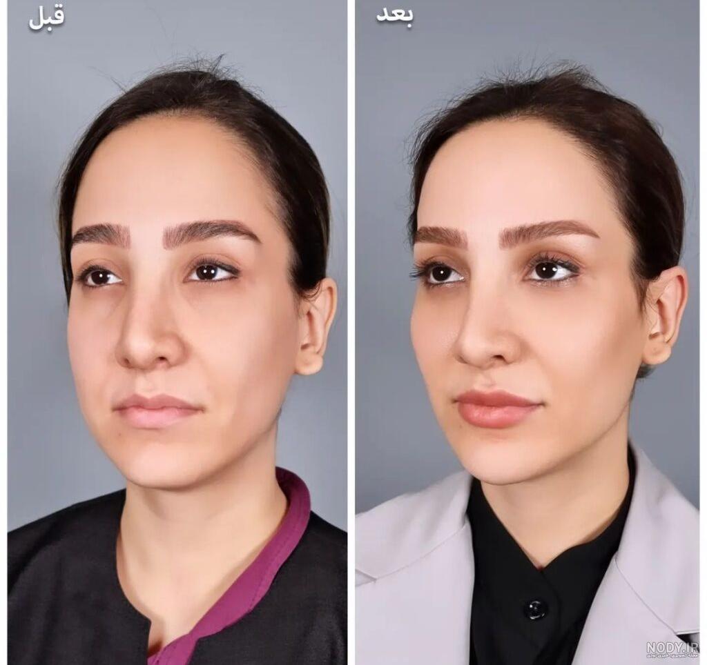 عکس بازیگران قبل و بعد آرایش عکس بازیگران قبل و بعد آرایش