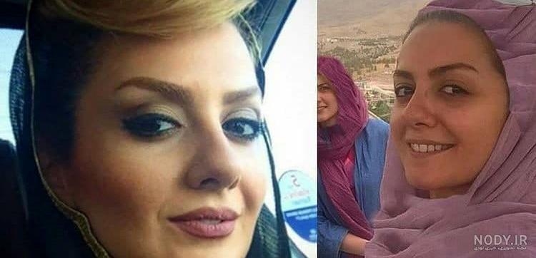 عکس قبل و بعد ارایش عکس قبل و بعد ارایش