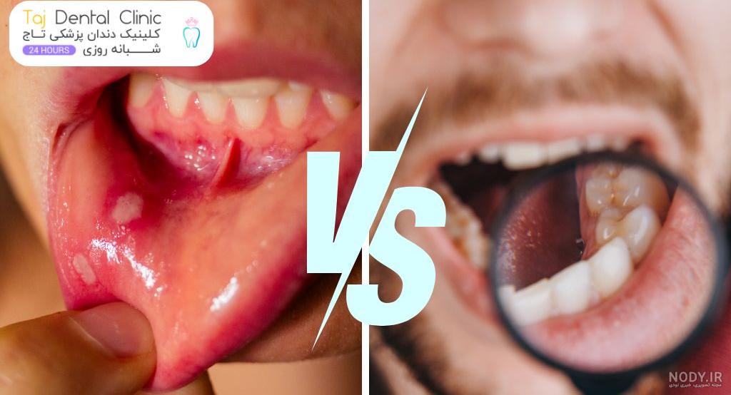 ویروس اچ پی وی (hpv) باعث چه بیماری‌هایی می‌شود؟ - درمان کلینیک