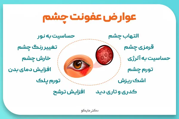 آشنایی با شایع ترین عفونت های چشمی آشنایی با شایع ترین عفونت های چشمی