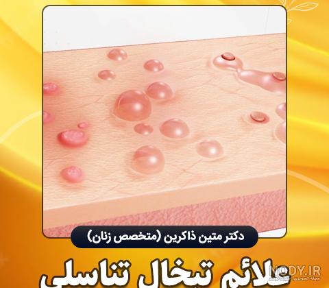تبخال تناسلی و روش های کاربردی برای درمان آن - سلامت بانوان اوما
