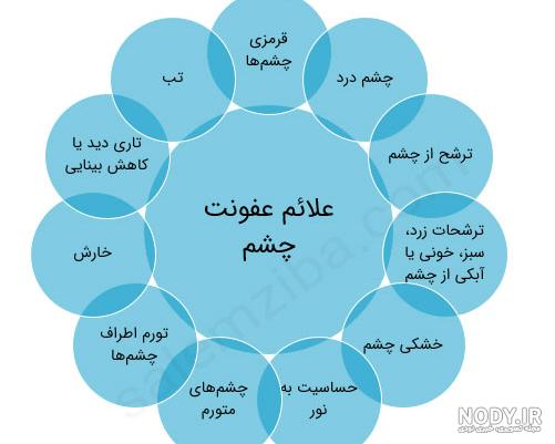 عفونت تبخال چشمی | بیماری های چشمی | دکتر آراز محمدزاده عفونت تبخال چشمی | بیماری های چشمی | دکتر آراز محمدزاده