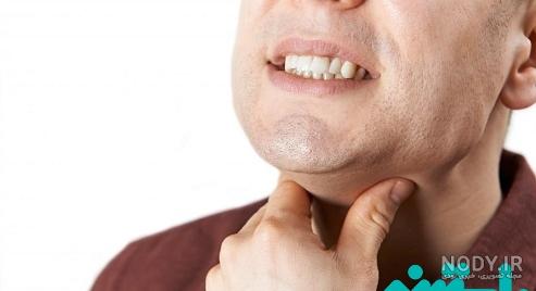 عکس عفونت ویروسی گلو