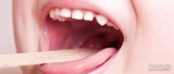 قرص برای گلو درد | بهترین قرص‌ها برای سرفه و گلو درد 💊