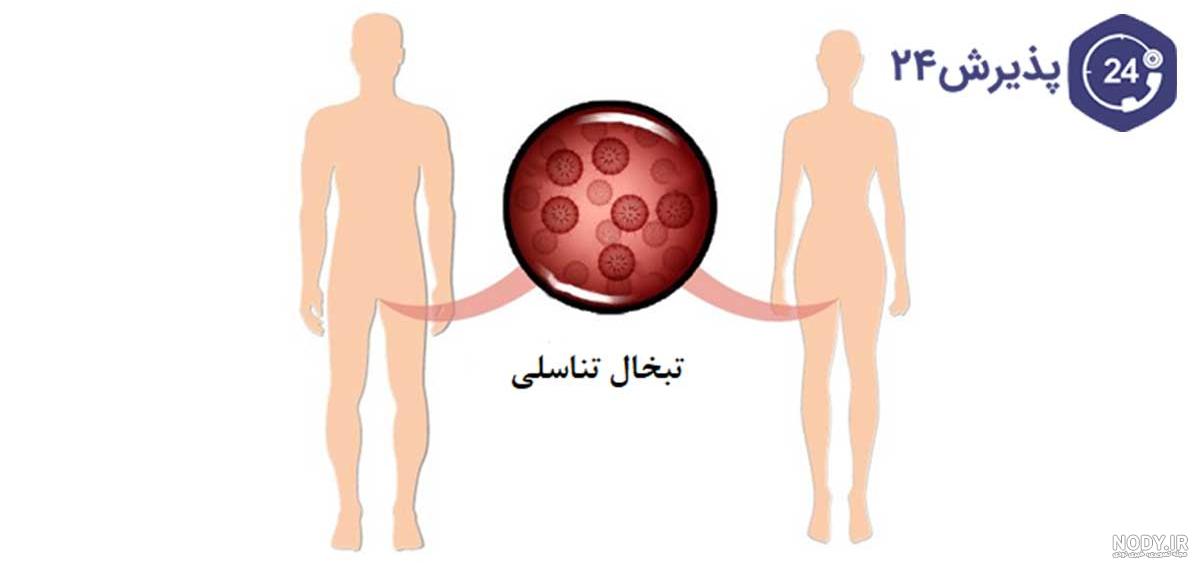 ویروس هرپس سیمپلکس - ویکی‌پدیا، دانشنامهٔ آزاد