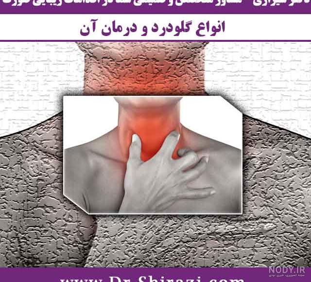 گلودرد چرکی ( استرپتوکوکی) چیست؟