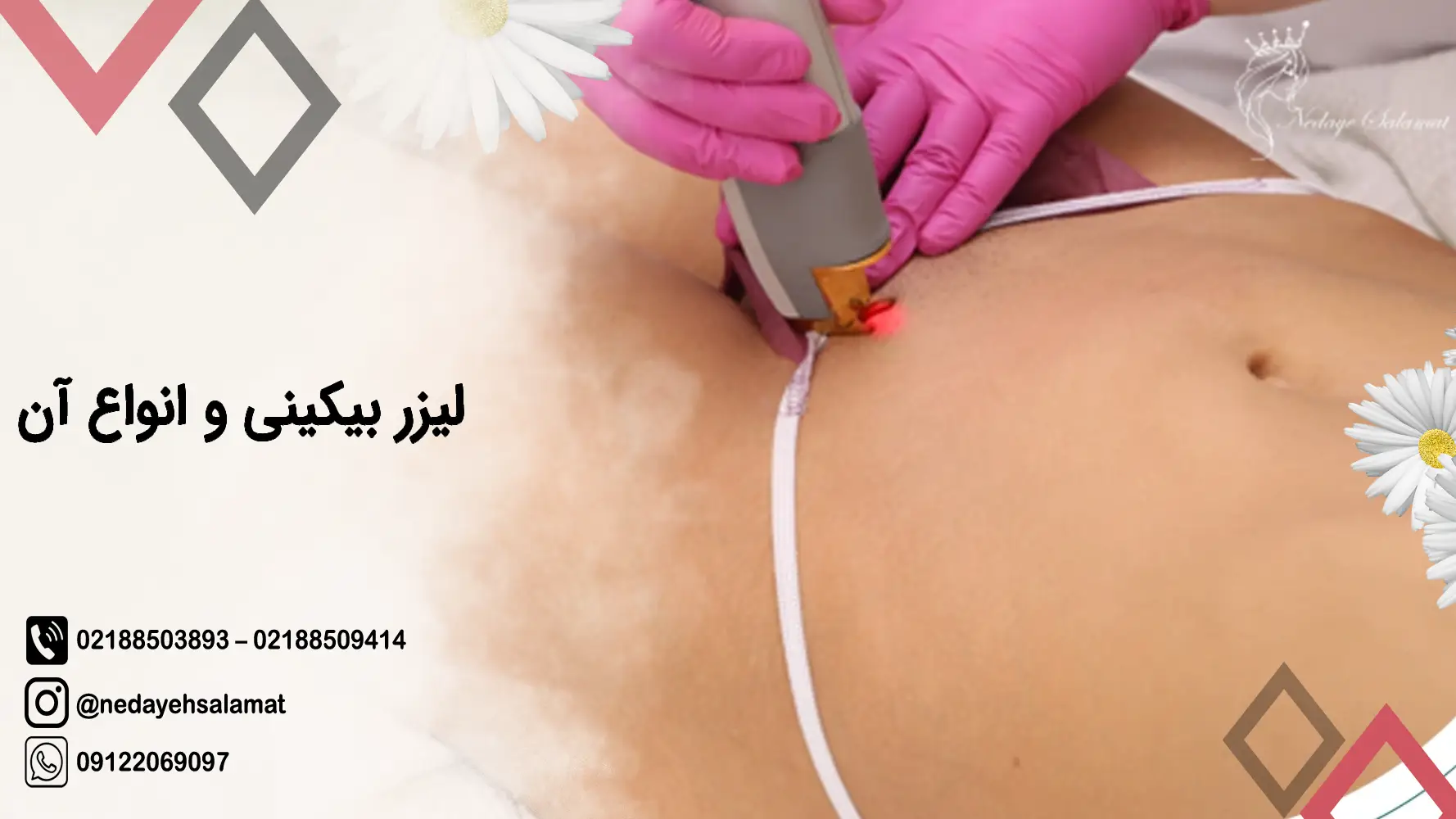 قیمت لیزر موهای زائد ناحیه تناسلی - هزینه لیزر مو ناحیه بیکینی چقدر است؟ - گلوریا سنتر قیمت لیزر موهای زائد ناحیه تناسلی - هزینه لیزر مو ناحیه بیکینی چقدر است؟ - گلوریا سنتر