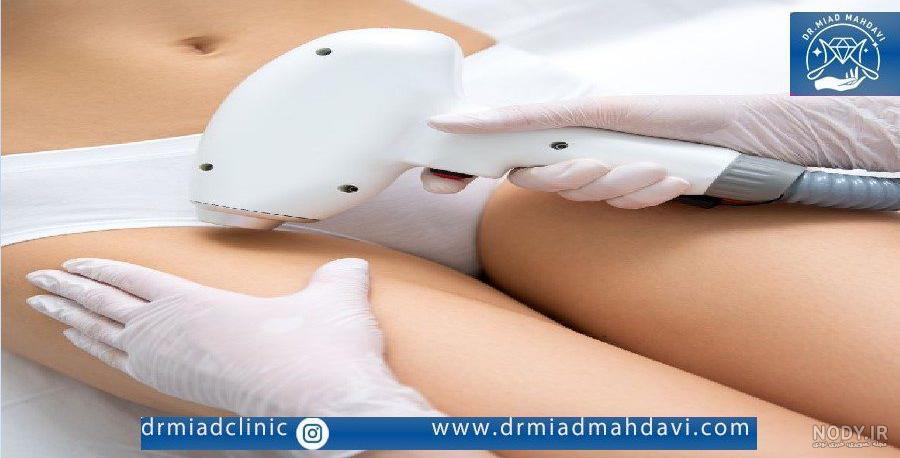 قیمت لیزر موهای زائد واژن در اصفهان-حکم شرعی لیزر بیکینی قیمت لیزر موهای زائد واژن در اصفهان-حکم شرعی لیزر بیکینی