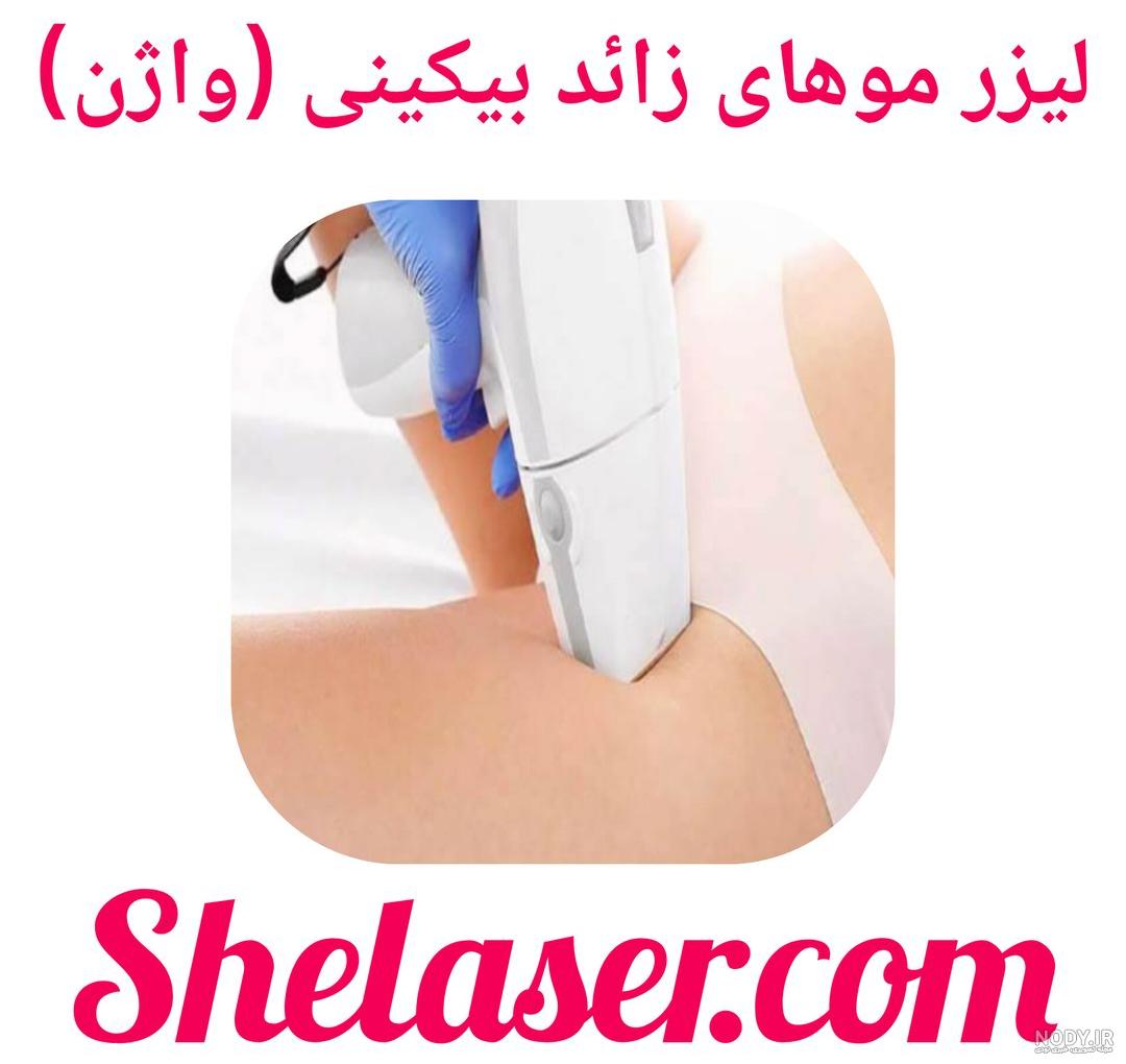 لیزر بیکینی چیست و شامل کجا است؟ - نحوه انجام، عوارض و هزینه لیزر بیکینی چیست و شامل کجا است؟ - نحوه انجام، عوارض و هزینه