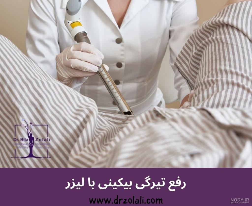لیزر مونالیزا تاچ: عوارض، مزایا، کاربردها و هزینه ها