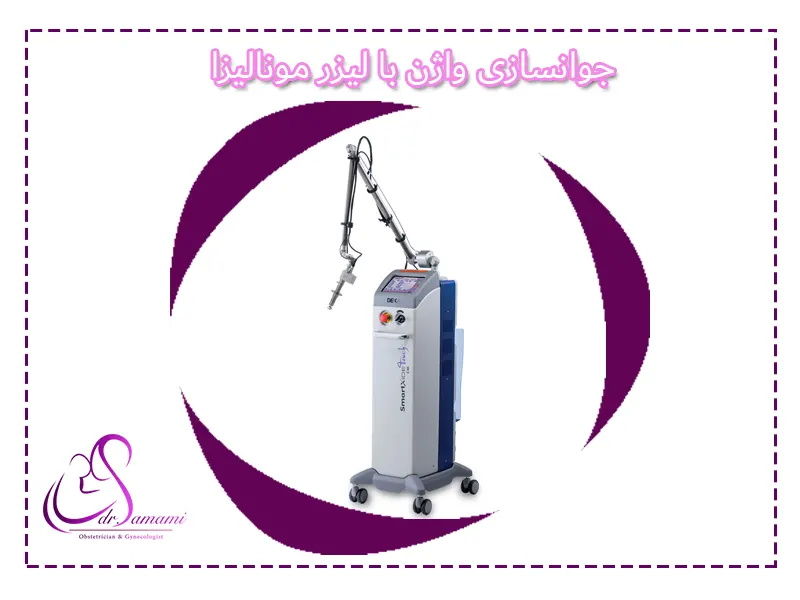معرفی لیزر مونالیزا تاچ، کاربردها و مزایا + ویدیو - کلینیک تخصصی زیبایی السا