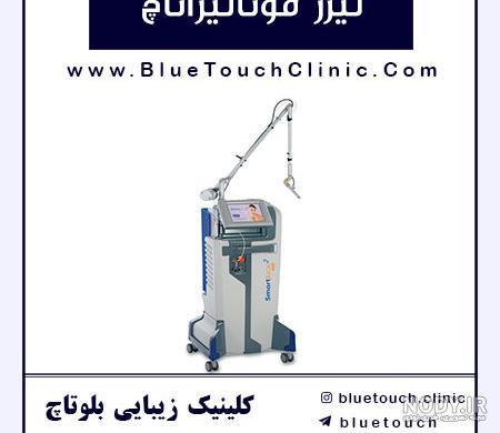 نحوه تنگ کردن واژن با لیزر به همراه فیلم + هزینه و تعداد جلسات - دکتر میترا  بهمن پور