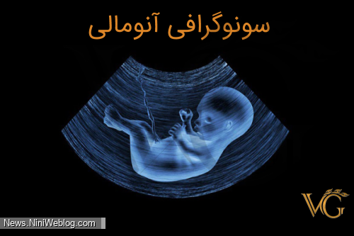 آنومالی اسکن چیست و در هفته چندم بارداری انجام می شود؟ | نی نی پلاس