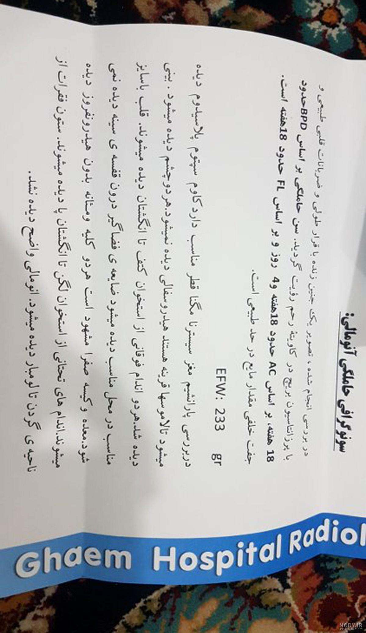 بهترین سونوگرافی در شرق تهران:سونوگرافی فرخ | مجله نی نی سایت