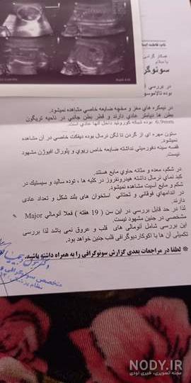 سونوگرافی تعیین جنسیت دختر وپسر😍😍😍😍😍+عکس صفحه 3 | تبادل نظر نی نی سایت