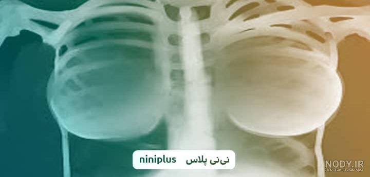 سی تی اسکن کرونا-بازار مدیکال