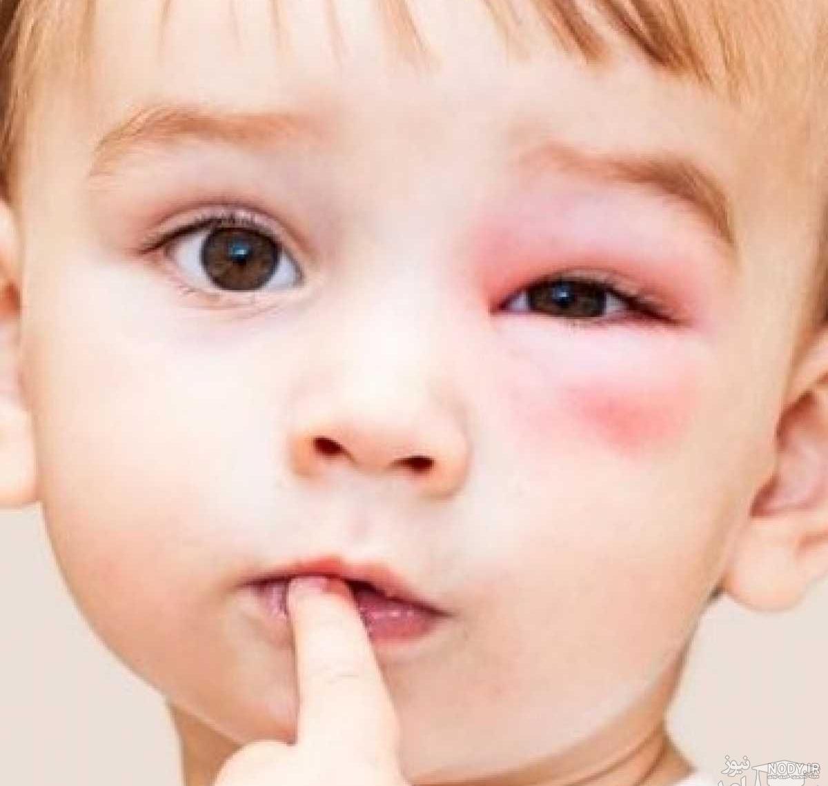عکس از چشم نی نی سایت