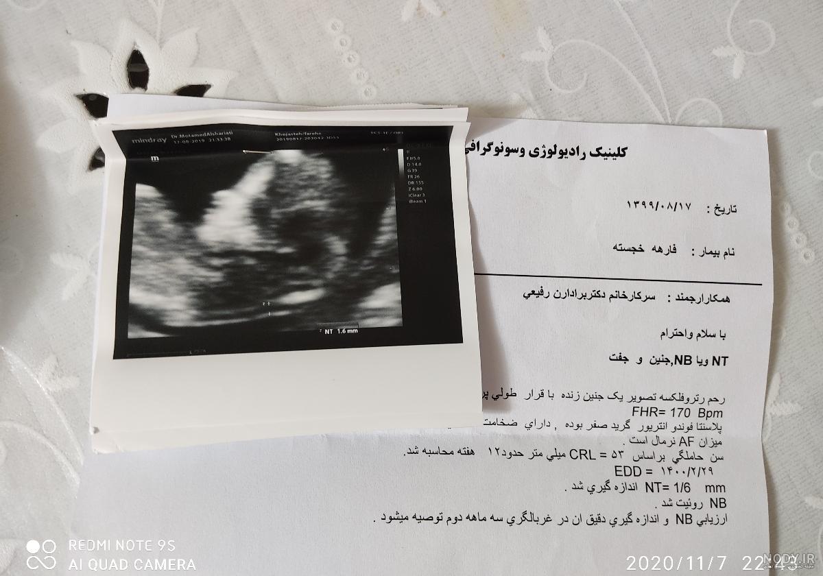 عکس سونو آنومالی | تبادل نظر نی نی سایت