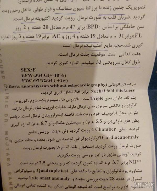 عکس سونو هفته 16...ببینید جنسیت چیه بنظرتون؟ صفحه 3 | تبادل نظر نی نی سایت