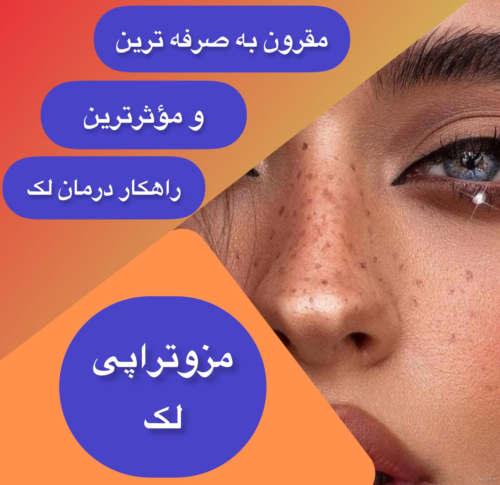 چرا باید از سرم دور چشم استفاده کنیم؟+ موارد استفاده و نتایج