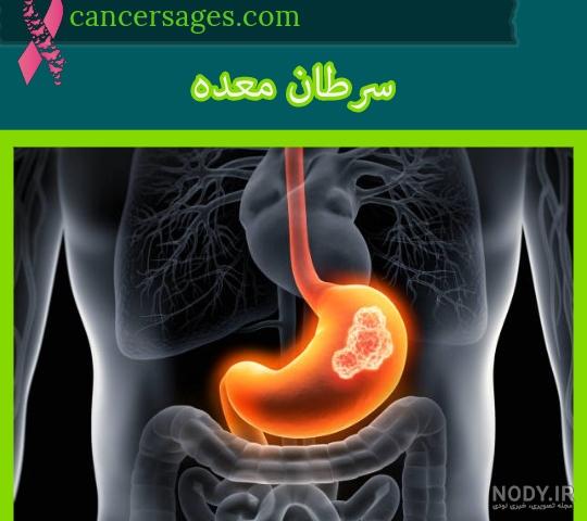 چگونه سی تی اسکن ریه خود را تفسیر کنیم؟ | راهنمای جامع ایران نوبت
