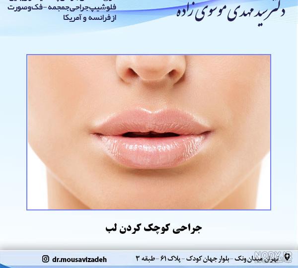 13 ترفند زیبایی - ایدههای خلاقانه رژ لب و آرایش لب 13 ترفند زیبایی - ایدههای خلاقانه رژ لب و آرایش لب