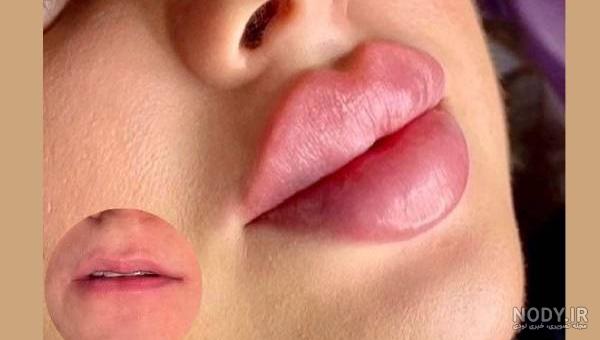 آرایش لب قلوه ای، لب های باریک و گوشتی [0 تا 100 تکنیک و فوت و فن] - ریحا