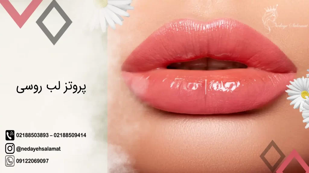 آموزش روشهای خانگی پروتز لب بدون عمل جراحی و تزریق آموزش روشهای خانگی پروتز لب بدون عمل جراحی و تزریق