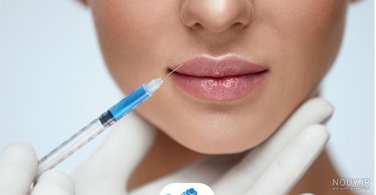 آموزش روشهای خانگی پروتز لب بدون عمل جراحی و تزریق آموزش روشهای خانگی پروتز لب بدون عمل جراحی و تزریق
