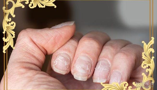 آموزش کاشت ناخن با پلی ژل – آکادمی مژده طبرستانی آموزش کاشت ناخن با پلی ژل – آکادمی مژده طبرستانی