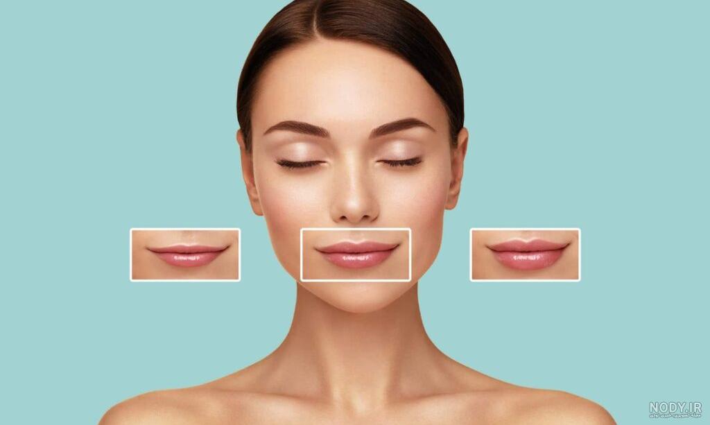 انواع مدل های تزریق ژل لب | دکتر لاغری انواع مدل های تزریق ژل لب | دکتر لاغری