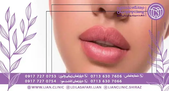 انواع مدل پروتز لب کدام‌اند؟؟ تفاوت‌های آن‌ها - دکتر لیلی هاشمی
