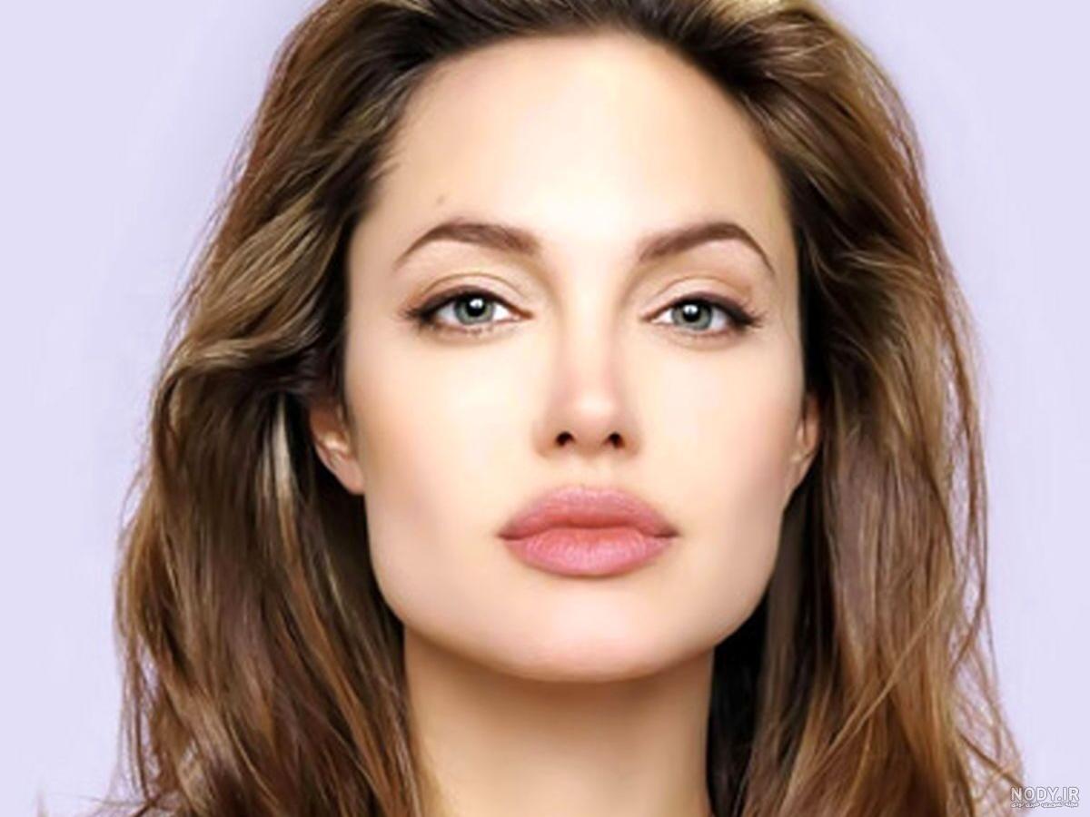 انواع مدل پروتز لب کدام‌اند؟؟ تفاوت‌های آن‌ها - دکتر لیلی هاشمی
