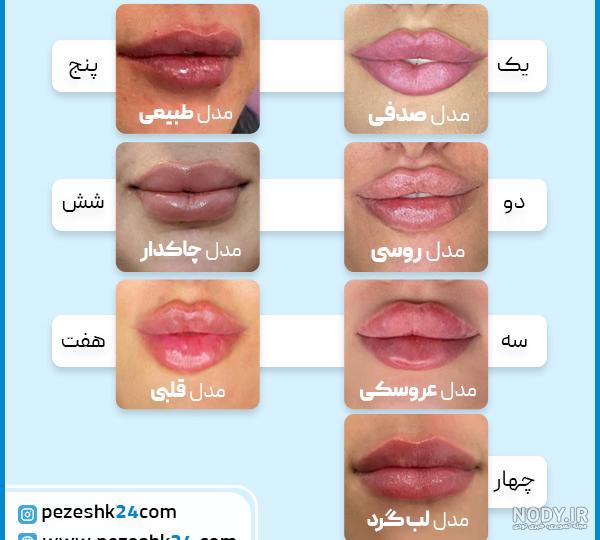 انواع مدل ژل لب | کلینیک لیزر سنتر انواع مدل ژل لب | کلینیک لیزر سنتر