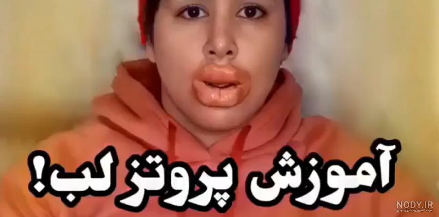 انواع پروتز لب چیست | عکس لب پروتزی طبیعی انواع پروتز لب چیست | عکس لب پروتزی طبیعی