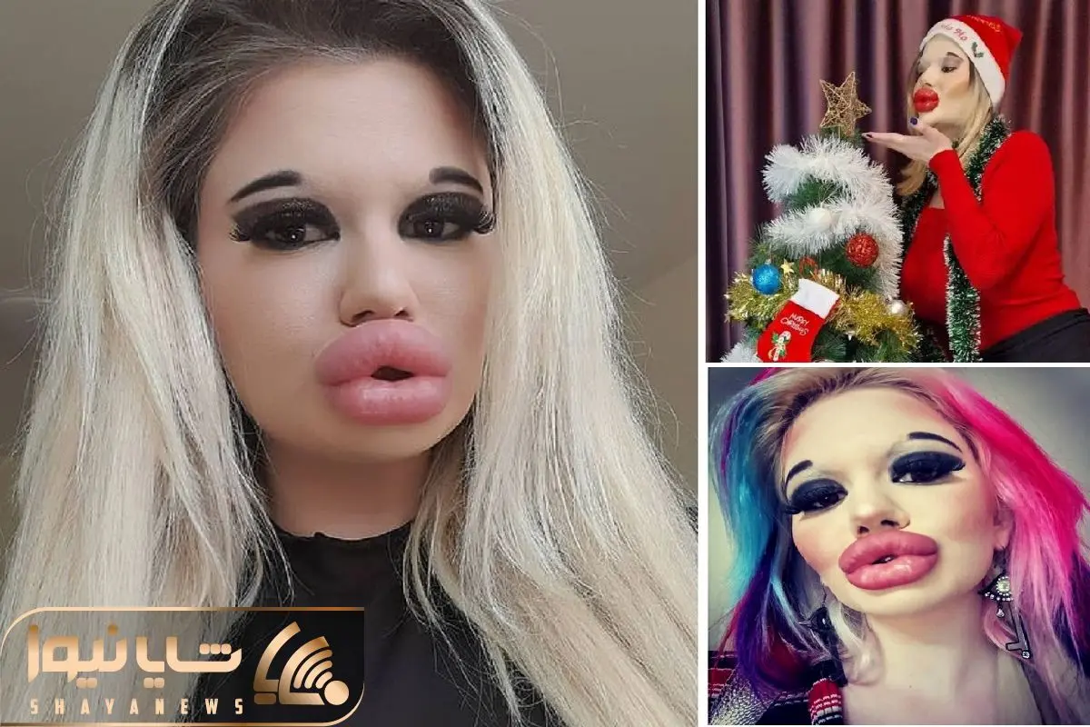 این دختر دارای بزرگترین لب های دنیا است+ عکس این دختر دارای بزرگترین لب های دنیا است+ عکس