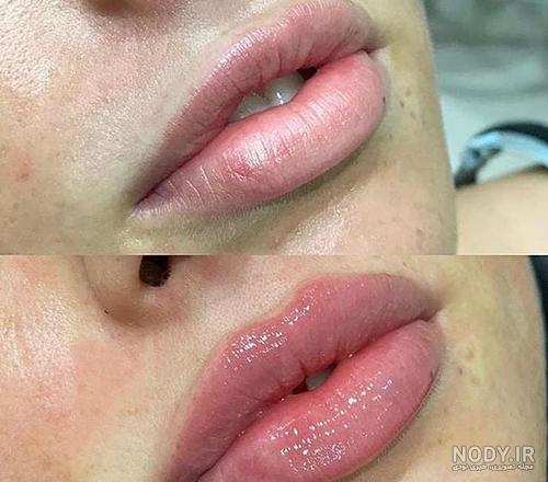 این دختره لباشو ژل زده؟🤔 +عکس📸 | تبادل نظر نی نی سایت