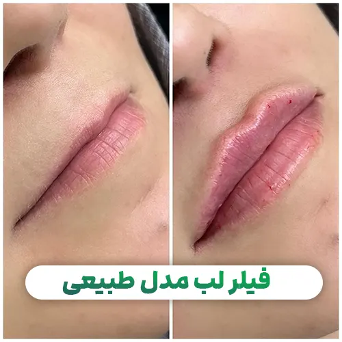 برق لب حرارتی طرح قلب موکوآلور مدل Tint lips mocoallure برق لب حرارتی طرح قلب موکوآلور مدل Tint lips mocoallure