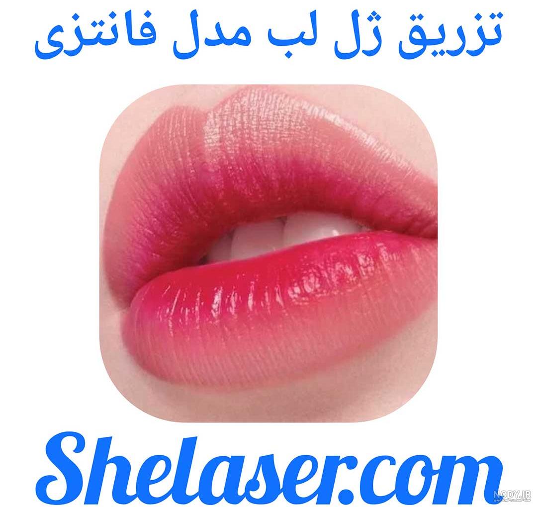 بزرگترین لب دنیا به این دختر تعلق دارد - عکس ویسگون بزرگترین لب دنیا به این دختر تعلق دارد - عکس ویسگون