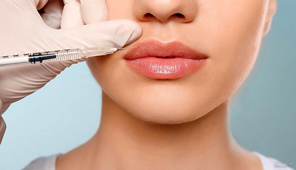 بهترین مارک ژل لب - 4 برند برتر دنیا بهترین مارک ژل لب - 4 برند برتر دنیا