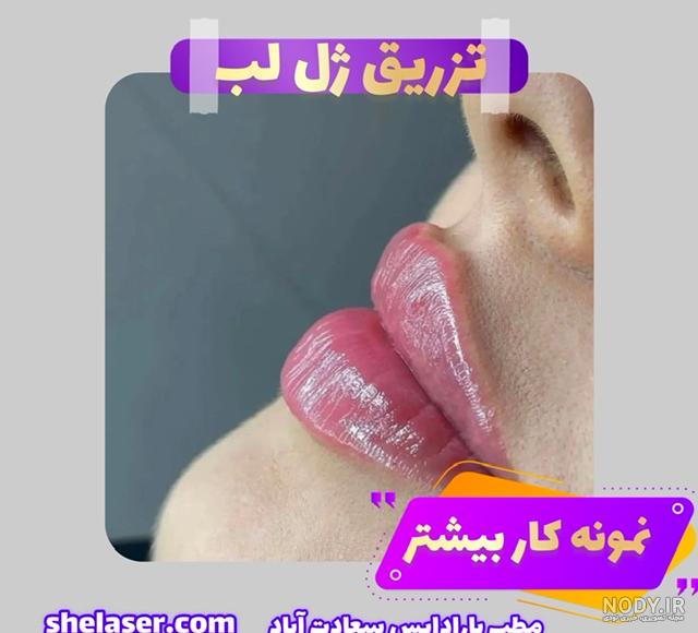 بهترین مارک ژل لب | بهترین ژل لب | بهترین نوع ژل لب | انواع ژل لب | ژل لب کره ای بهترین مارک ژل لب | بهترین ژل لب | بهترین نوع ژل لب | انواع ژل لب | ژل لب کره ای