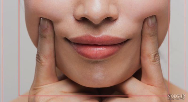 تزریق فیلر خط خنده و جدی‌ترین مزایا و معایب فیلر خنده | پذیرش۲۴