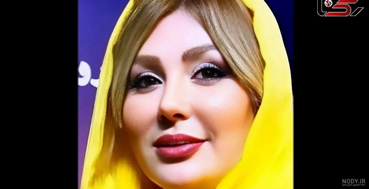 تزریق ژل خط خنده + عکس قبل و بعد فیلر خط لبخند❤️ | دکتر تفت تزریق ژل خط خنده + عکس قبل و بعد فیلر خط لبخند❤️ | دکتر تفت