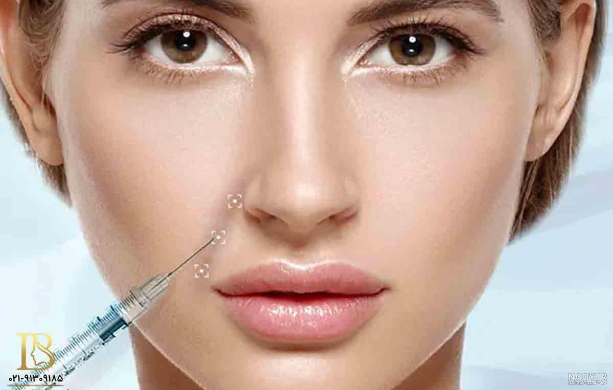 تزریق ژل خط خنده - معرفی بهترین مارک ها - مزایا + معایب - دکتر امامی تزریق ژل خط خنده - معرفی بهترین مارک ها - مزایا + معایب - دکتر امامی