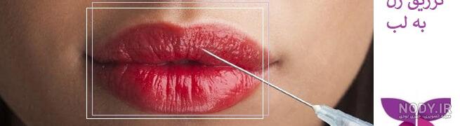 تزريق ژل|فیلر لب روسی|بوتاکس|مدلینگ|لیفت|drlip|دکترلیپ‎ (@drlip_beauty) •  Instagram photos and videos