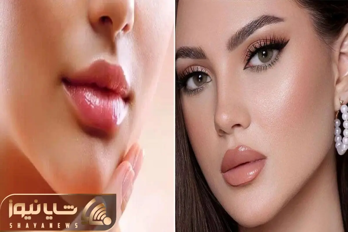 تزریق ژل لب و انواع مدل های آن - دکتر پیشگاهی تزریق ژل لب و انواع مدل های آن - دکتر پیشگاهی
