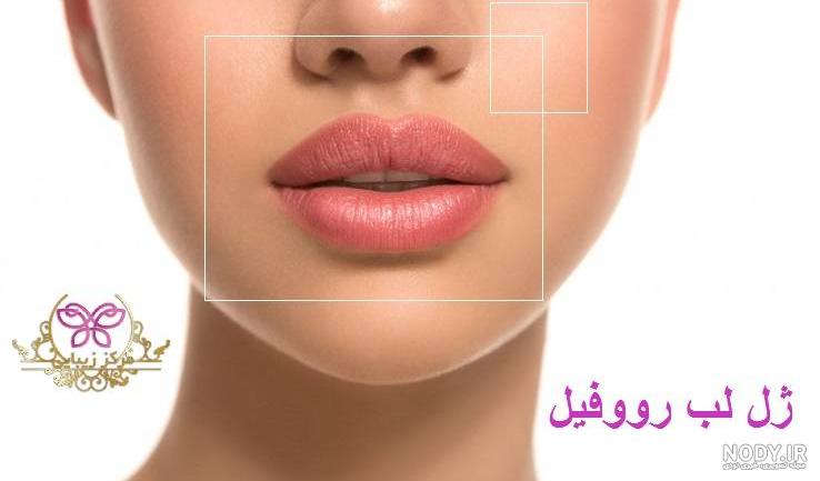 تزریق ژل لب و انواع مدل های آن - دکتر پیشگاهی تزریق ژل لب و انواع مدل های آن - دکتر پیشگاهی