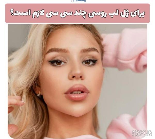 تزریق ژل لب در تهران | راهنمای کامل + قیمت به‌روز